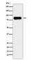 Aconitase 2 Antibody