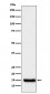 TTC11 Antibody