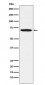 LIMK1 Antibody