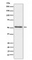 Prostatic Acid Phosphatase Antibody