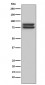 FOXP1 Antibody