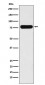 Villin-1  Antibody