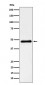 Pancreatic Lipase （PNLIP） Antibody