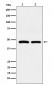 FDFT1 Antibody