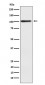 Alpha actinin 2 Antibody