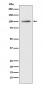 ATP2A1/SERCA1 Antibody