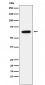 Estrogen Receptor alpha Antibody