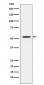 MMP1 Antibody