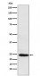 BAG2 Antibody