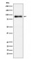 Lactoferrin Antibody