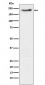 Phospho-ErbB3 (Y1222) Antibody