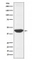 IDH1 Antibody