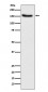 Hamartin Antibody