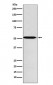 ACVR1B Antibody