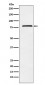 NDUFS1 Antibody