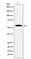 GGT1 Antibody