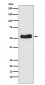 Glucokinase Antibody