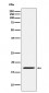 FHIT Antibody