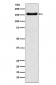 ATP7b Antibody