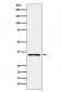 KLK2 Antibody