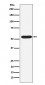 PIAS2 Antibody