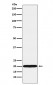 UBE2C Antibody