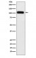 SERCA1 ATPase Antibody