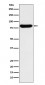 GUSB Antibody