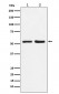 P4HB Antibody