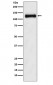 ANPRB Antibody