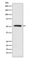 ETV6 Antibody