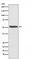 ACVR1 Antibody