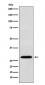 KGF Antibody