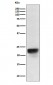 FSH beta Antibody