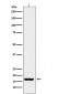 Histone H3 (acetyl K18) Antibody