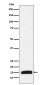 Histone H3 (mutated K27 Met) Antibody