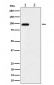 Phospho-FGFR3 (Y724) Antibody