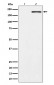 Phospho-ErbB2 (Y1139) Antibody