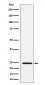 SOD2 (acetyl K68) Antibody