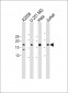 PTMS Antibody (C-term)