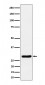 Calcipressin 1 Antibody