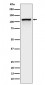 Phospho-CBL (Y774) Antibody