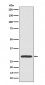 Galectin 3 Antibody