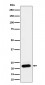 NDUFB9 Antibody