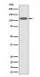 ZHX2 Antibody