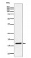 Ube2L3 / UBCH7 Antibody