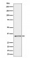 CYB5R3 Antibody