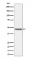 BCKDK Antibody