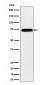 HNRNPM Antibody