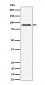 ACAP2 Antibody